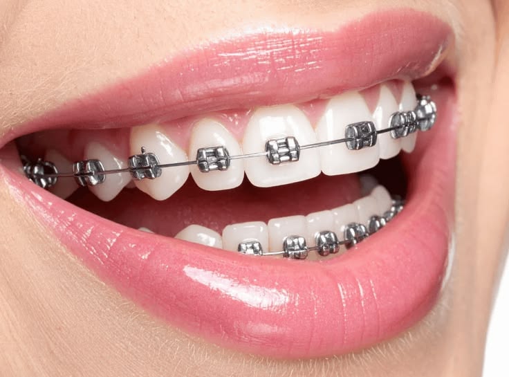 Orthodontics